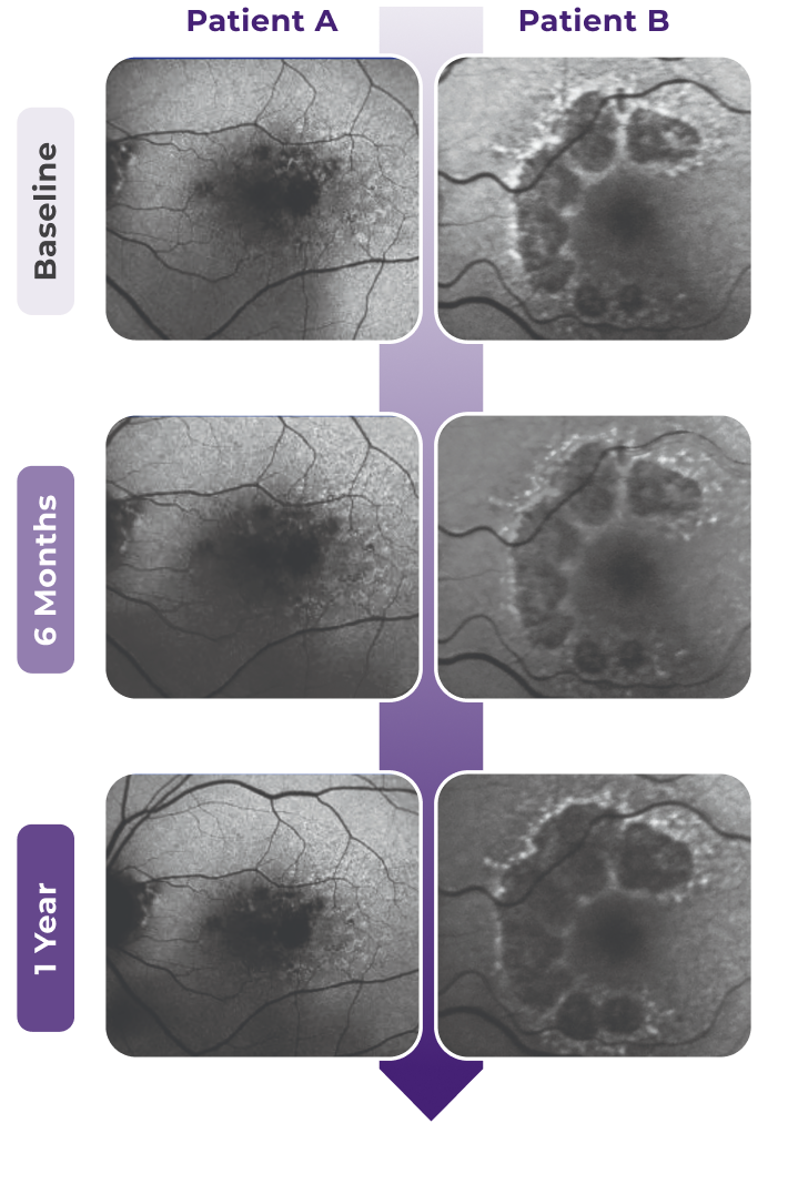Image of GA progression